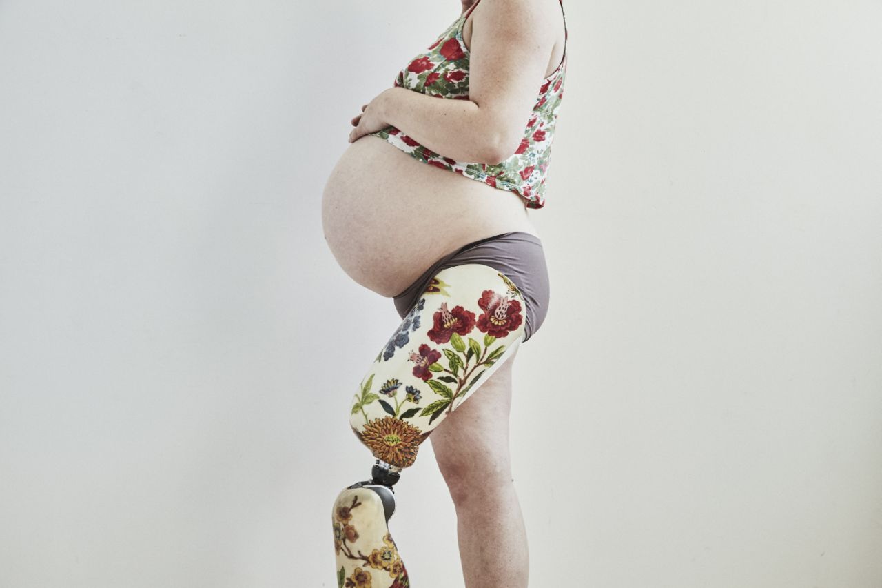 Amputee mom poses in maternity shoot and changes minds